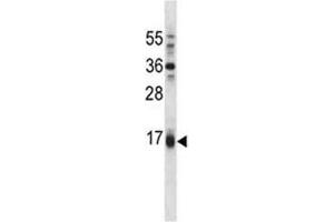 Puma antibody western blot analysis in A549 lysate. (PUMA 抗体  (AA 109-137))