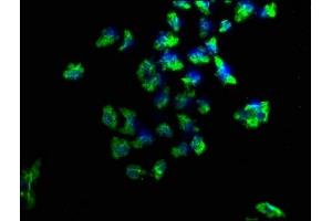 Immunofluorescence staining of Hela cells with ABIN7169031 at 1:100, counter-stained with DAPI. (PKC mu 抗体  (AA 674-904))