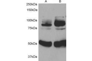 Western blot testing of rat aortic smooth muscle cells before (1) and after (2) infection with human APPL1 adenovirus for 48hrs. (APPL1 抗体)
