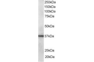 Western Blotting (WB) image for anti-PDZ and LIM Domain 1 (PDLIM1) (C-Term) antibody (ABIN2466090) (PDLIM1 抗体  (C-Term))