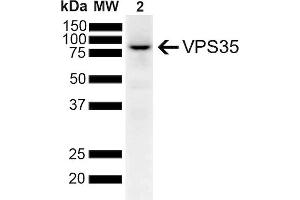 Western Blot analysis of Human SH-SY5Y lysates showing detection of 91. (VPS35 抗体  (PE))