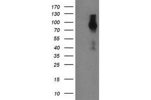 Western Blotting (WB) image for anti-Fibroblast Growth Factor Receptor 2 (FGFR2) antibody (ABIN1498252) (FGFR2 抗体)