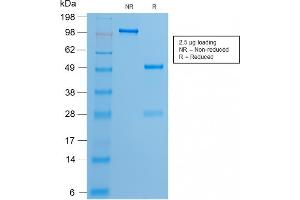 SDS-PAGE Analysis of Purified Estrogen Receptor, alpha Rabbit Recombinant Monoclonal Antibody (ESR1/2299R). (Recombinant Estrogen Receptor alpha 抗体)