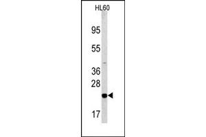 Image no. 2 for anti-BCL2-Associated Agonist of Cell Death (BAD) (Middle Region) antibody (ABIN356826) (BAD 抗体  (Middle Region))