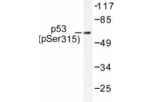 Image no. 1 for anti-Tumor Protein P53 (TP53) (pSer315) antibody (ABIN318092) (p53 抗体  (pSer315))