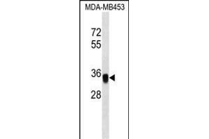 EpC Antibody (C-term) (ABIN1536832 and ABIN2849616) western blot analysis in MDA-M cell line lysates (35 μg/lane). (EpCAM 抗体  (C-Term))