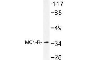 Image no. 1 for anti-Melanocortin 1 Receptor (MC1R) antibody (ABIN317707) (MC1 Receptor 抗体)