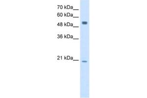 Western Blotting (WB) image for anti-B Lymphoid Tyrosine Kinase (BLK) antibody (ABIN2462928) (BLK 抗体)