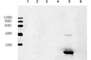 Primary antibody: 1 µg/mL FGF acidic Antibody, mAb, mouse (ABIN399028) Secondary antibody: IRDye800 Conjugated affinity purified anti-Mouse IgG [GOAT] (1: 10,000) Loading: Lane 1: hFGF-6 recombinant protein (200 ng) Lane 2: hFGF-16 recombinant protein (200 ng) Lane 3: hFGF-17 recombinant protein (200 ng) Lane 4: hFGF-18 recombinant protein (200 ng) Lane 5: FGF acidic recombinant protein (200 ng) Lane 6: FGF basic recombinant protein (200 ng) (FGF acidic 抗体)