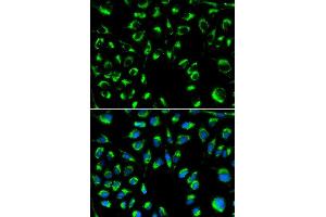 Immunofluorescence analysis of MCF-7 cells using PPP4C antibody (ABIN5971135). (PPP4C 抗体)