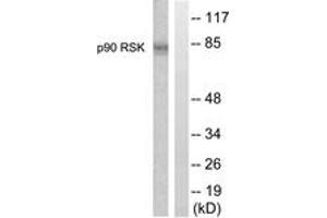 Western Blotting (WB) image for anti-Ribosomal Protein S6 Kinase, 90kDa, Polypeptide 1 (RPS6KA1) (AA 331-380) antibody (ABIN2888685) (RPS6KA1 抗体  (AA 331-380))
