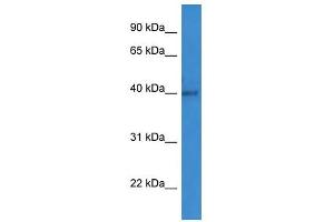 Western Blot showing ART1 antibody used at a concentration of 1-2 ug/ml to detect its target protein. (ART1 抗体  (C-Term))