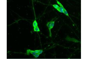 Immunofluorescent staining of differentiated SH-SY5Y cells (Human neuroblastoma, ATCC CRL-2266) (right). (S100B 抗体  (AA 1-92))