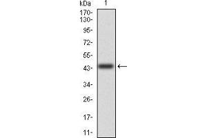 Western blot analysis using CD6 mAb against human CD6(AA: 18-199) recombinant protein. (CD6 抗体  (AA 18-199))