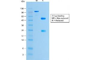 SDS-PAGE (SDS) image for anti-Histone H1 antibody (ABIN6939600)