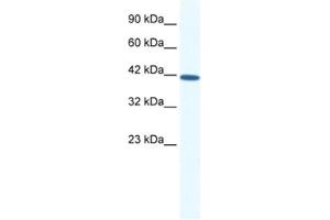 Western Blotting (WB) image for anti-SRY (Sex Determining Region Y)-Box 11 (SOX11) antibody (ABIN2460694) (SOX11 抗体)