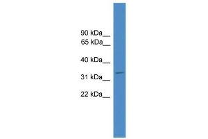 Ccnd1 antibody used at 0. (Cyclin D1 抗体  (C-Term))