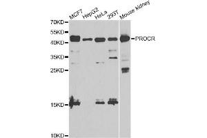 Western blot analysis of extracts of various cell lines, using PROCR antibody. (PROCR 抗体)