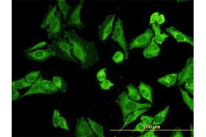 Immunofluorescence (IF) image for anti-Nodal Homolog (NODAL) (AA 275-346) antibody (ABIN562016)