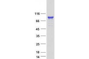 Validation with Western Blot (ADD3 Protein (Transcript Variant 1) (Myc-DYKDDDDK Tag))