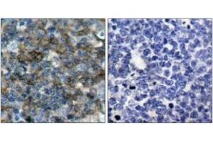 Immunohistochemistry (IHC) image for anti-Vasodilator-Stimulated phosphoprotein (VASP) (pSer157) antibody (ABIN2888553) (VASP 抗体  (pSer157))