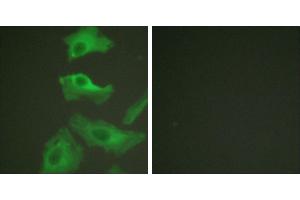 TNF-a + -Immunofluorescence analysis of HeLa cells, treated with TNF-a (20nM, 15mins), using HSP90B (Ab-254) antibody (#B0013). (HSP90AB1 抗体  (Ser254))