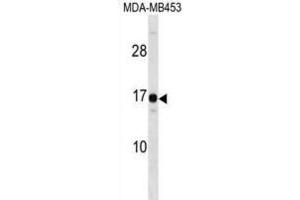 Western Blotting (WB) image for anti-High Mobility Group Nucleosomal Binding Domain 3 (HMGN3) antibody (ABIN2999006) (HMGN3 抗体)