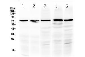 Western blot analysis of Raf1 using anti-Raf1 antibody . (RAF1 抗体  (AA 364-451))