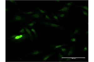 Immunofluorescence of monoclonal antibody to SUB1 on HeLa cell. (SUB1 抗体  (AA 32-124))