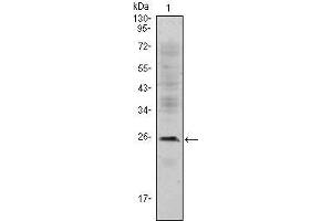 Western Blot showing CD3E antibody used against Jurkat (1) cell lysate. (CD3 epsilon 抗体)