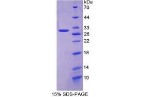 SDS-PAGE analysis of Mouse APP Protein. (APP 蛋白)