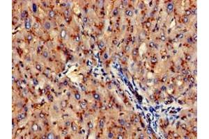 Immunohistochemistry of paraffin-embedded human liver tissue using ABIN7144005 at dilution of 1:100 (CD13 抗体  (AA 34-219))