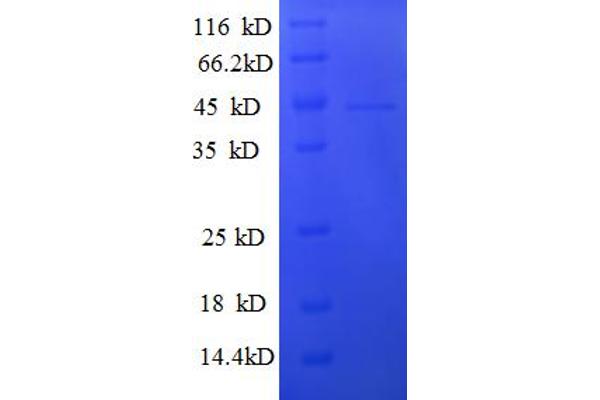 GTF2F2 Protein (AA 2-249) (His-SUMO Tag)