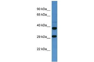Western Blotting (WB) image for anti-Somatostatin Receptor 2 (SSTR2) (C-Term) antibody (ABIN2505939) (SSTR2 抗体  (C-Term))