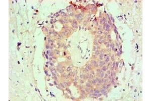 Immunohistochemical of paraffin-embedded Human endometrium tissue using ABIN7145293 at dilution of 1:200 (BCL2L1 抗体)