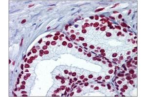 Human Prostate: Formalin-Fixed, Paraffin-Embedded (FFPE) (Histone H4 抗体  (acLys5))