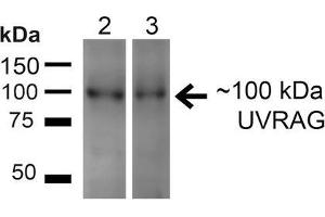 Western blot analysis of Human HeLa and 293T cell lysates showing detection of ~100kDa UVRAG protein using Rabbit Anti-UVRAG Polyclonal Antibody . (UVRAG 抗体  (PerCP))