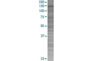 DHX16 transfected lysate. (DHX16 293T Cell Transient Overexpression Lysate(Denatured))