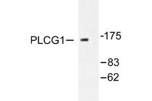 Image no. 2 for anti-phospholipase C, gamma 1 (PLCG1) antibody (ABIN271786) (Phospholipase C gamma 1 抗体)