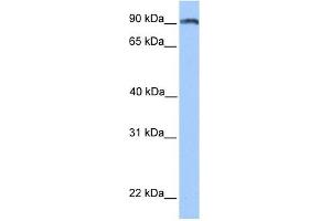 ANKS3 antibody used at 1 ug/ml to detect target protein. (ANKS3 抗体  (N-Term))