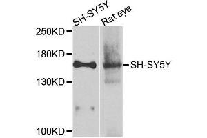 Western blot analysis of extracts of various cell lines, using ADCY2 antibody (ABIN6003537) at 1/1000 dilution. (ADCY2 抗体)