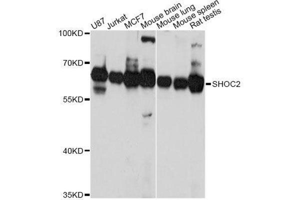 SHoc2/Sur8 抗体  (AA 1-280)
