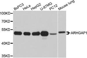 Western blot analysis of extracts of various cell lines, using ARHGAP1 antibody. (ARHGAP1 抗体)