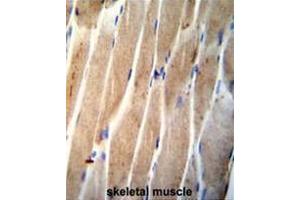 CLEC4F Antibody (C-term) immunohistochemistry analysis in formalin fixed and paraffin embedded human skeletal muscle followed by peroxidase conjugation of the secondary antibody and DAB staining. (CLEC4F 抗体  (C-Term))