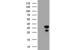 HEK293T cells were transfected with the pCMV6-ENTRY control (Left lane) or pCMV6-ENTRY RGS16 (Right lane) cDNA for 48 hrs and lysed. (RGS16 抗体)