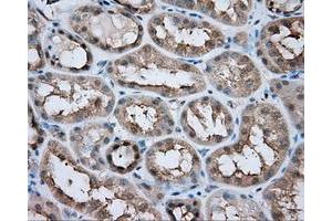 Immunohistochemical staining of paraffin-embedded liver tissue using anti-LIPG mouse monoclonal antibody. (LIPG 抗体)