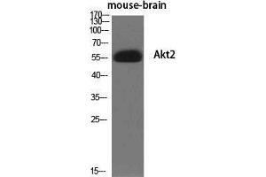 Western Blot (WB) analysis of specific cells using Akt2 Polyclonal Antibody. (AKT2 抗体  (Ser138))