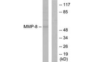 Western Blotting (WB) image for anti-Matrix Metallopeptidase 8 (Neutrophil Collagenase) (MMP8) (AA 418-467) antibody (ABIN2889234) (MMP8 抗体  (AA 418-467))