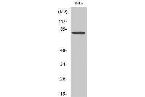 Western Blotting (WB) image for anti-Forkhead Box O1 (FOXO1) (Ser38) antibody (ABIN3175130) (FOXO1 抗体  (Ser38))