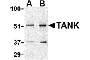 Western Blotting (WB) image for anti-TRAF Family Member-Associated NFKB Activator (TANK) (N-Term) antibody (ABIN1031602) (TANK 抗体  (N-Term))